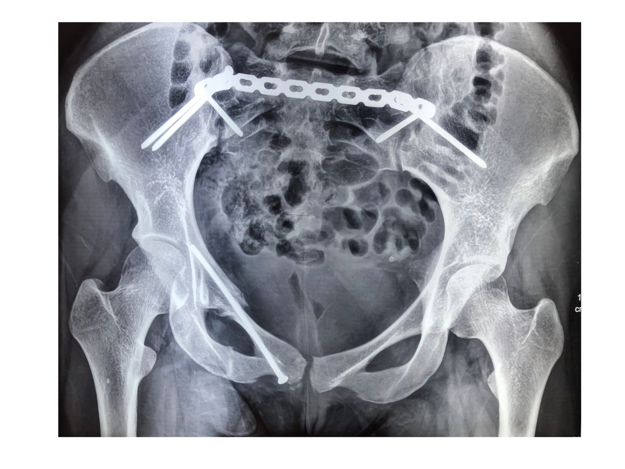 Marco Antonio Altamirano Cruz-8