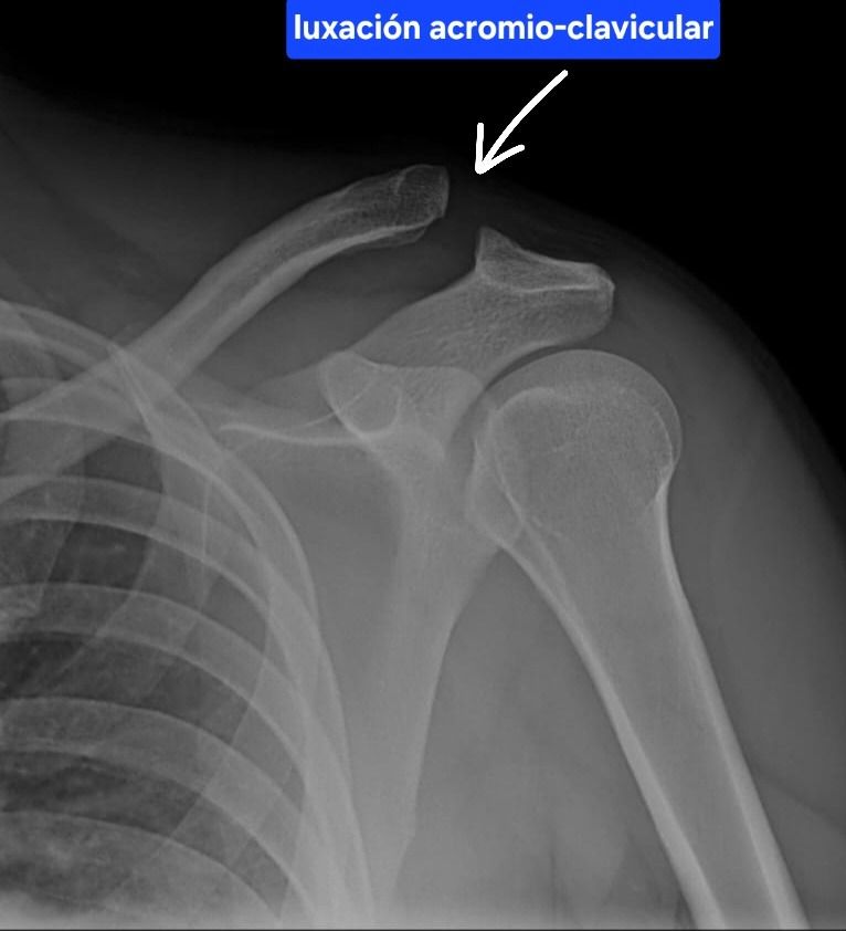 Juan Miguel Vargas Martínez-8