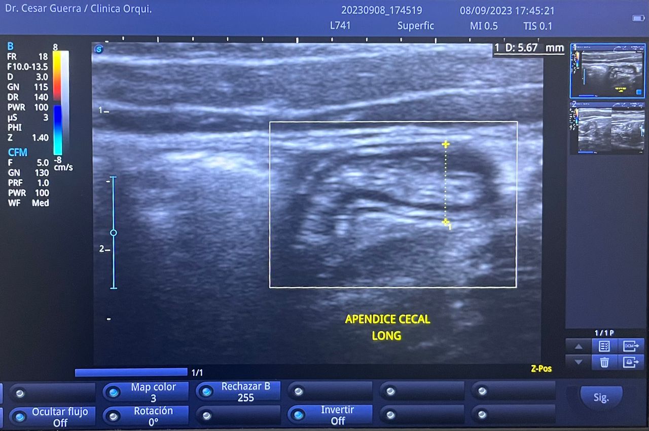 César Guerra Martínez-37