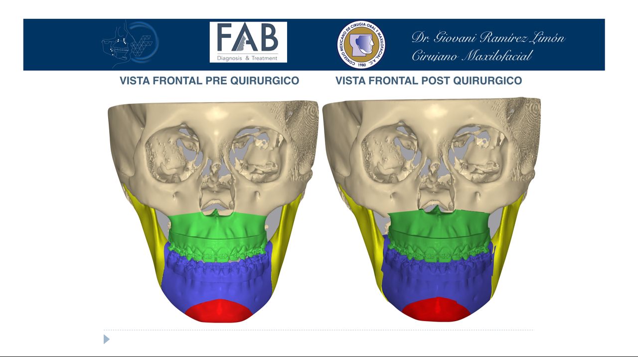 Giovani Ramírez Limón-25