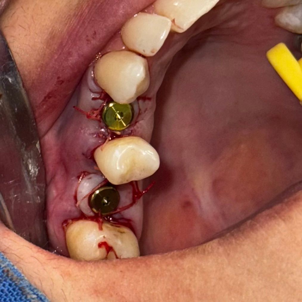 Diego Alan Cardiel Caraveo-9