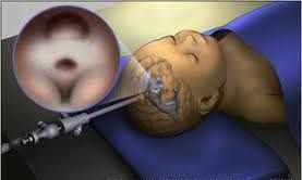 Anibal Fuentes Manzo-1