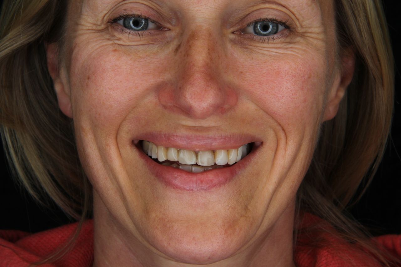 Arturo Mendez Valencia-16