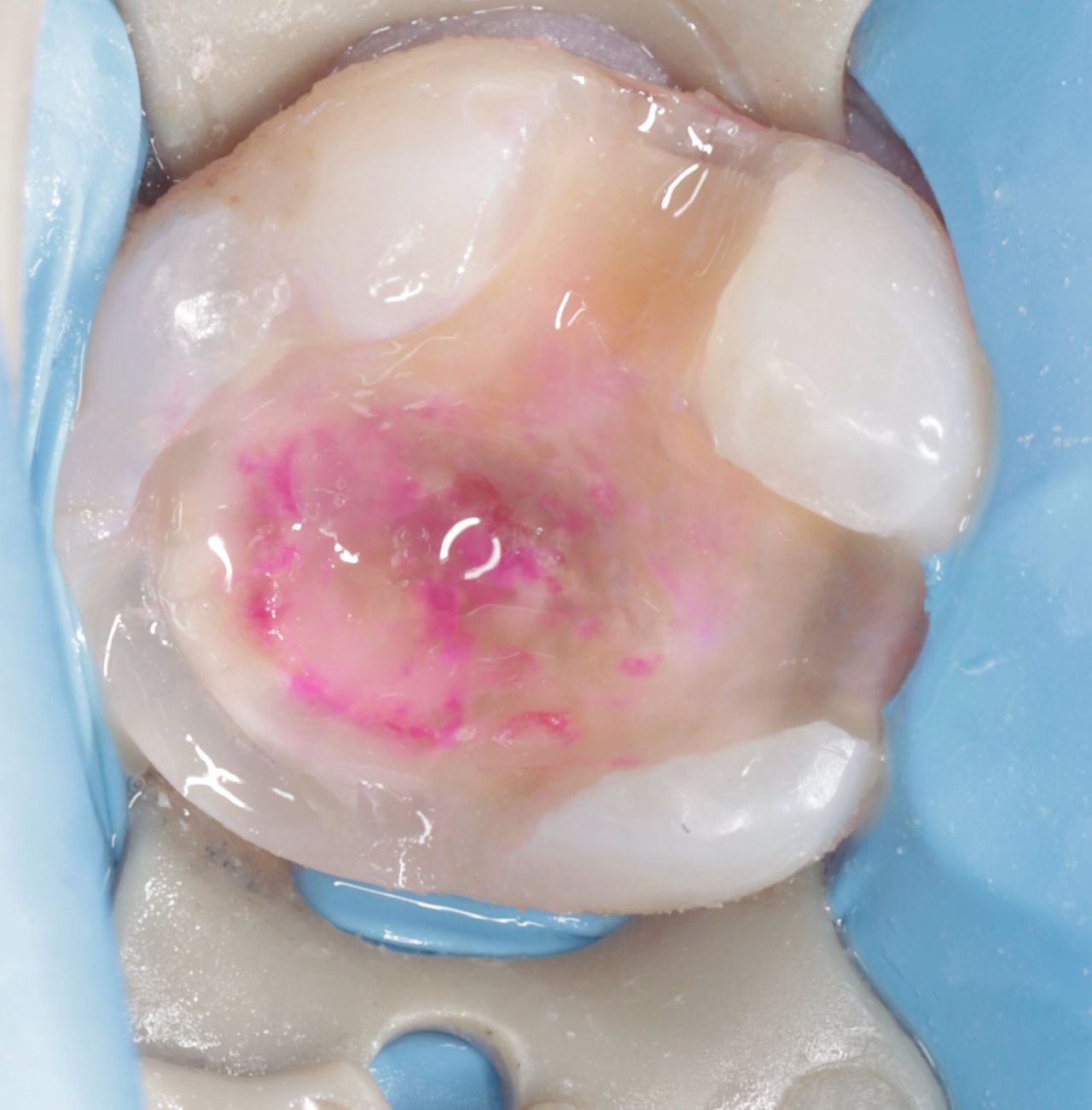 Fredy Alejandro Roblero Gónzalez-54