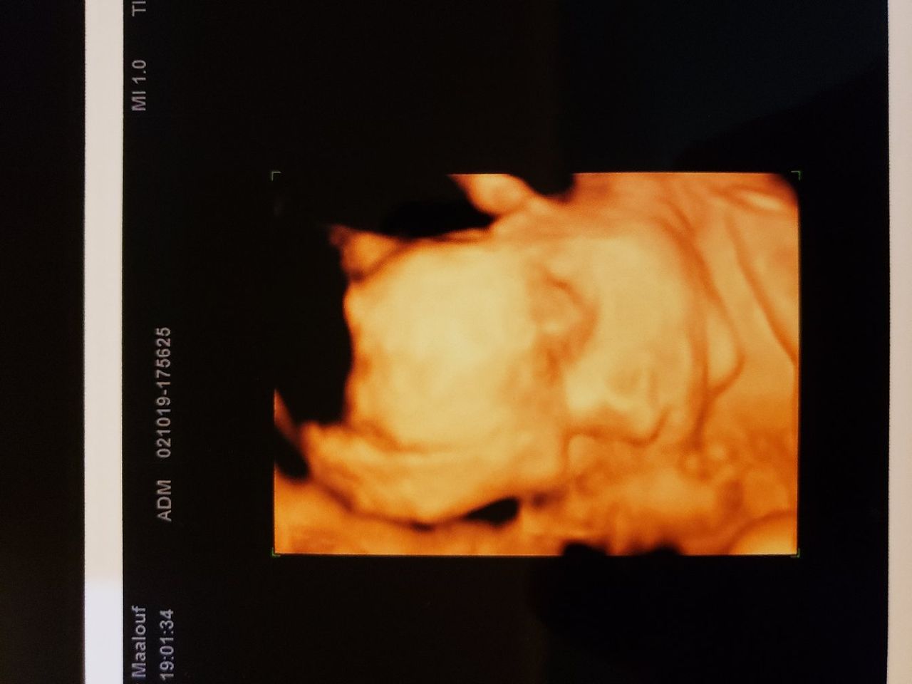 Tony Maalouf Fahme-1