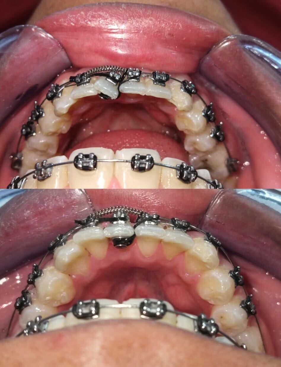 Luz Anel Valente Lozano-15