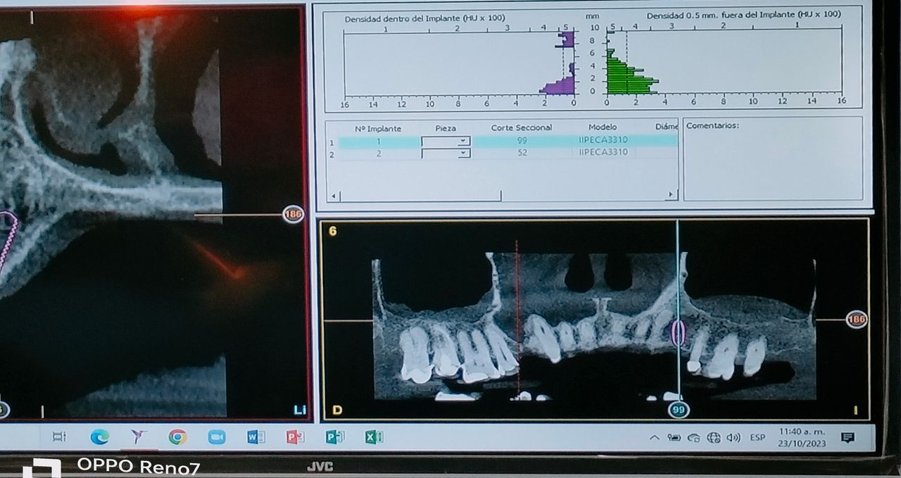 Yaneth Gutiérrez Sánchez-38