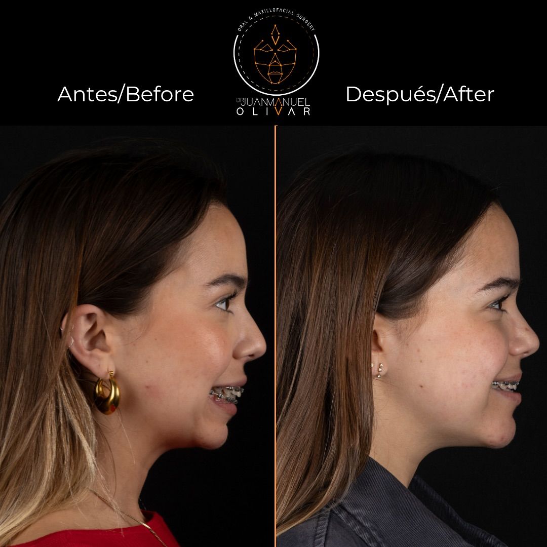 Juan Manuel Olivar Cedeño-5