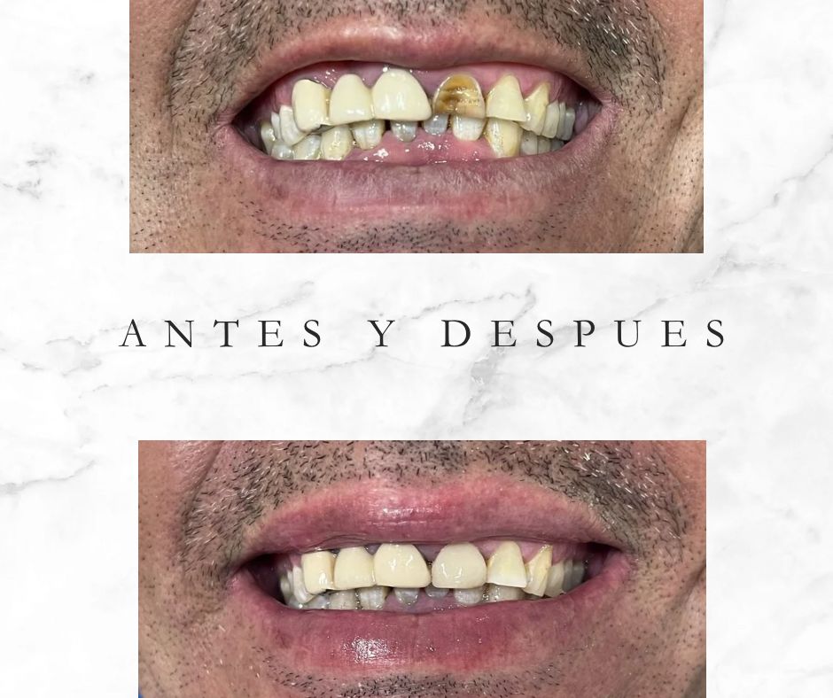 Noe Arturo Cortazar Sánchez-7