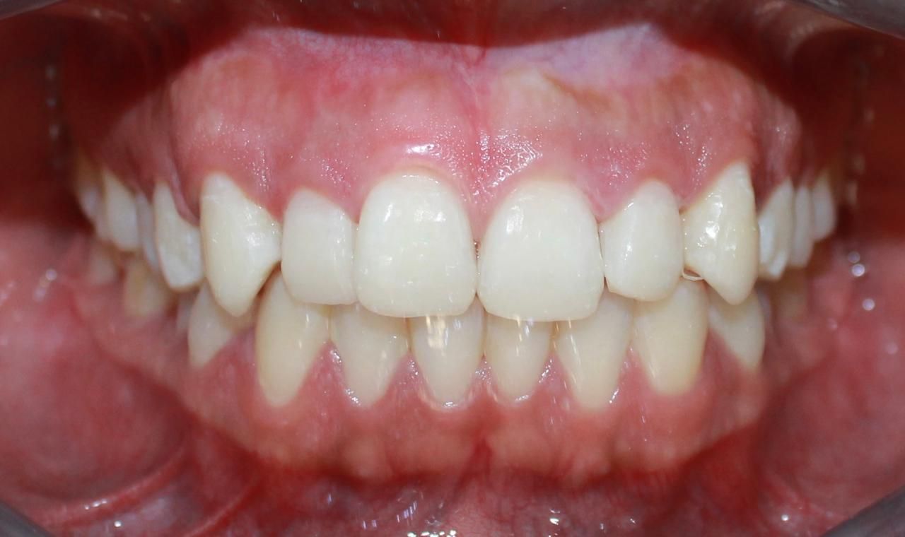 Jonathan Ortiz Zorraquin-14