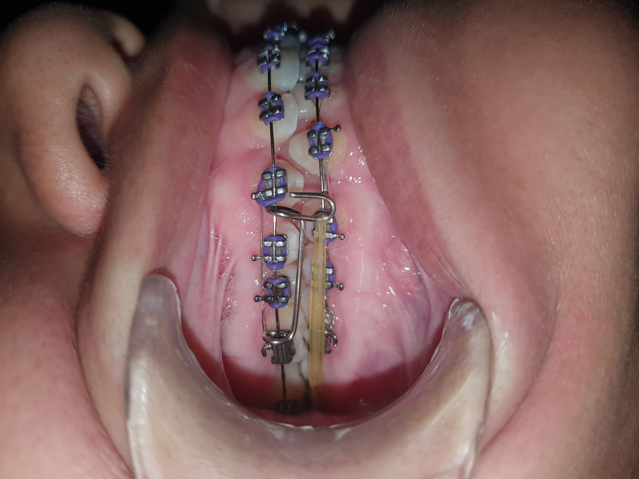 Fabiola Arcos Huesca-43