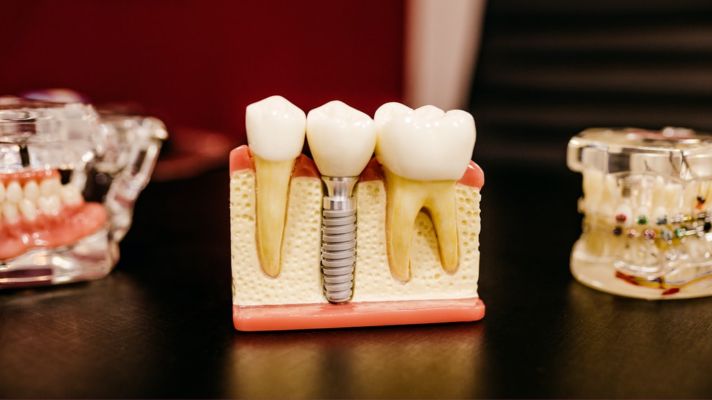 Javier Ibáñez Brambila-1