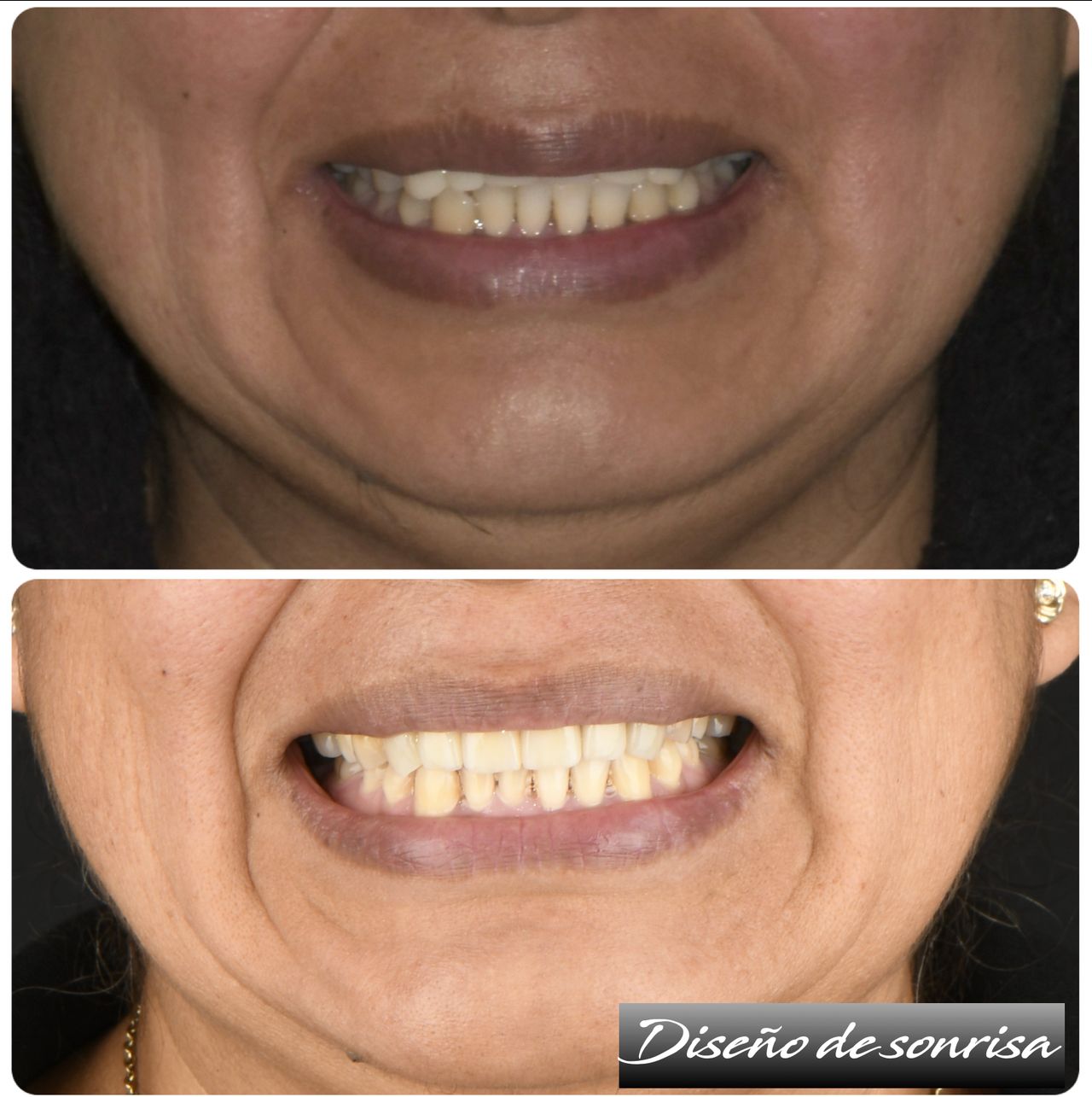 Josué Eli Ortiz López-1