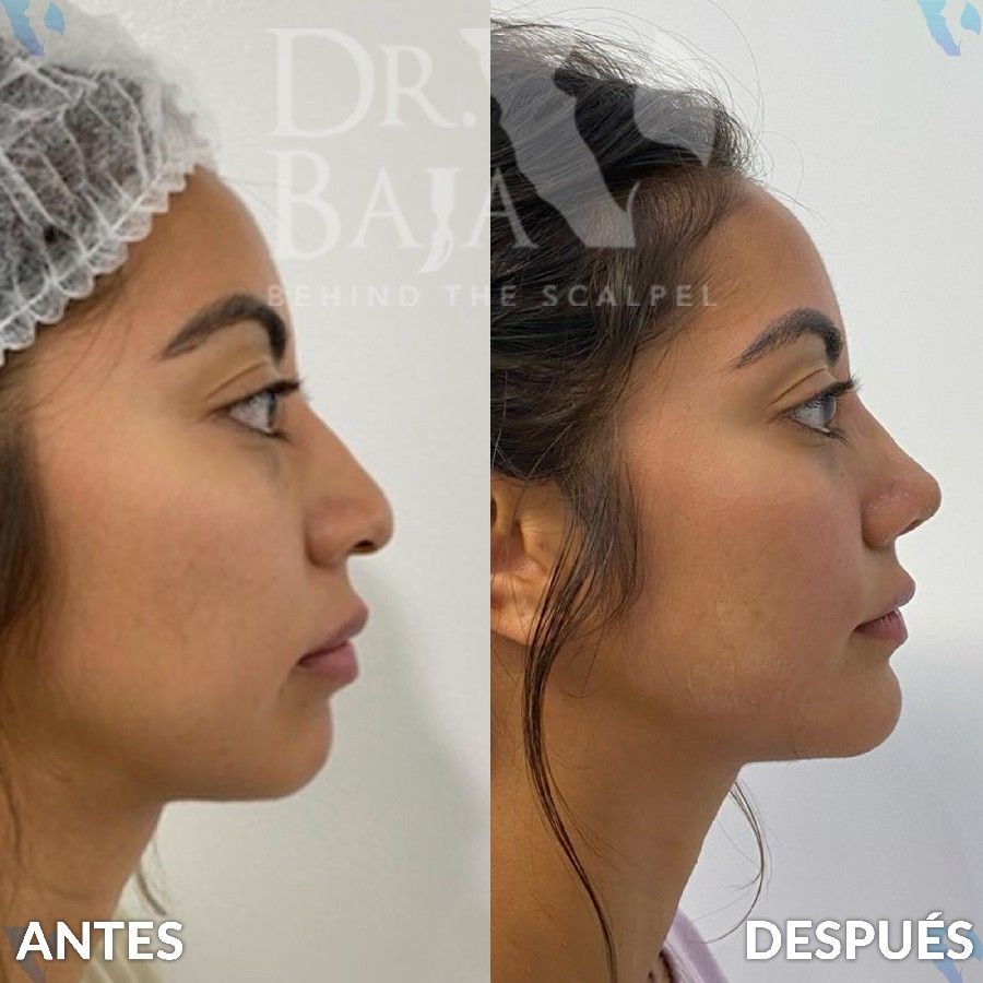 Renato Rodríguez Hirales-20