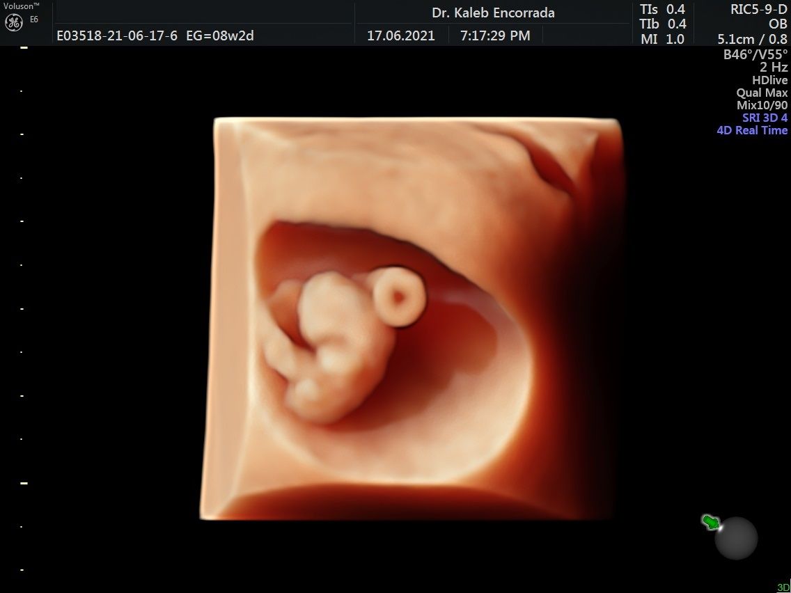 Hugo Kaleb Encorrada Luarca-16