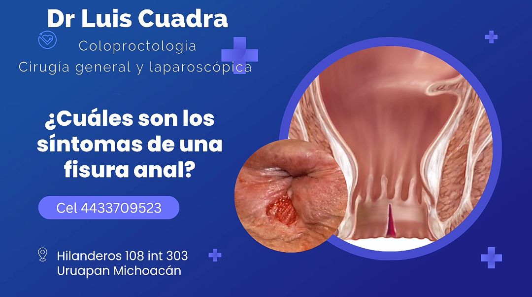 Luis Angel Cuadra Reyes-9