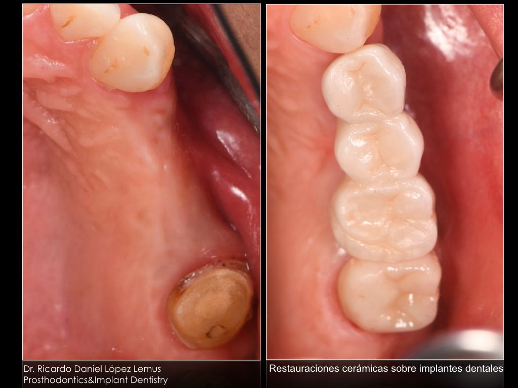 Ricardo López Lemus-42