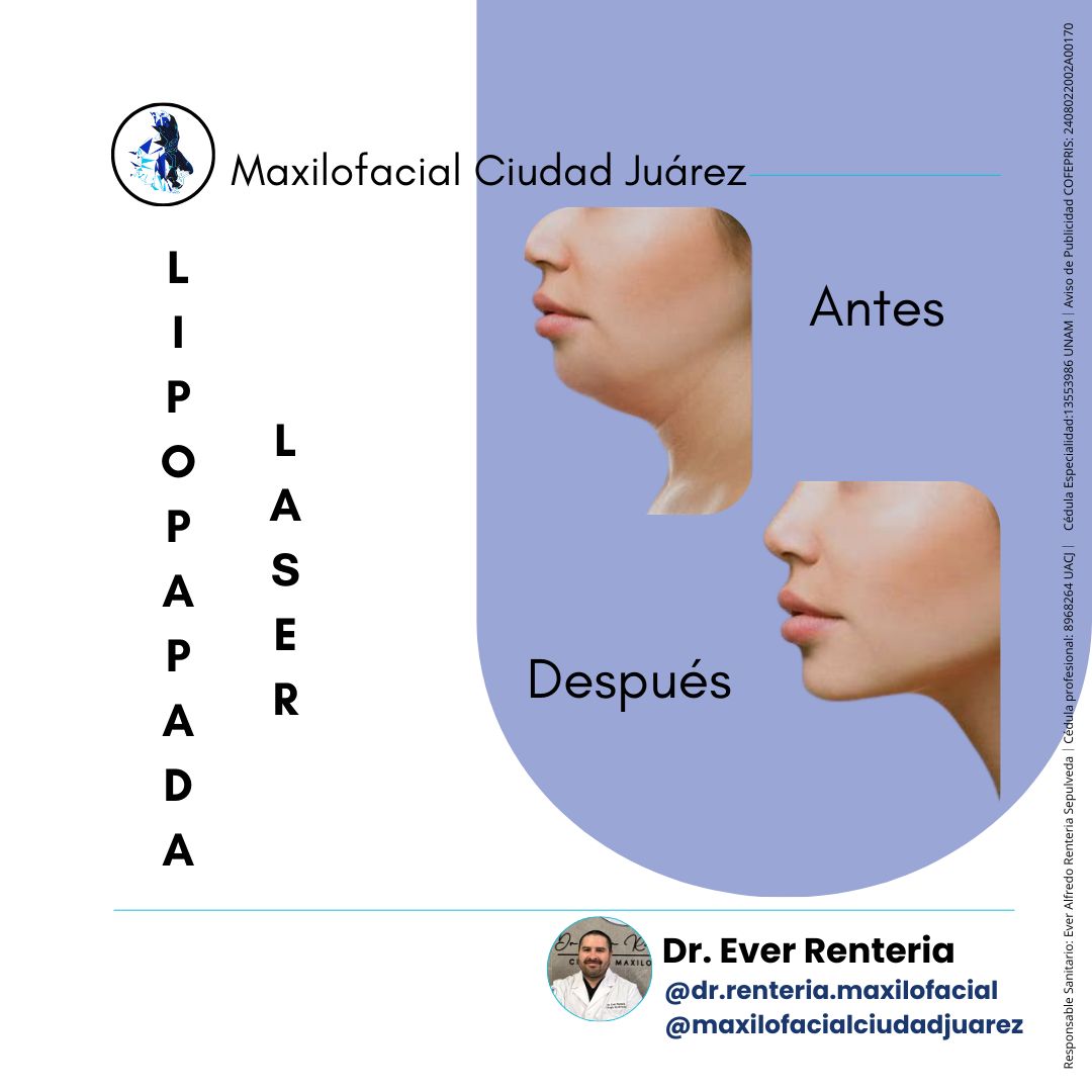 Ever Renteria Sepulveda-6