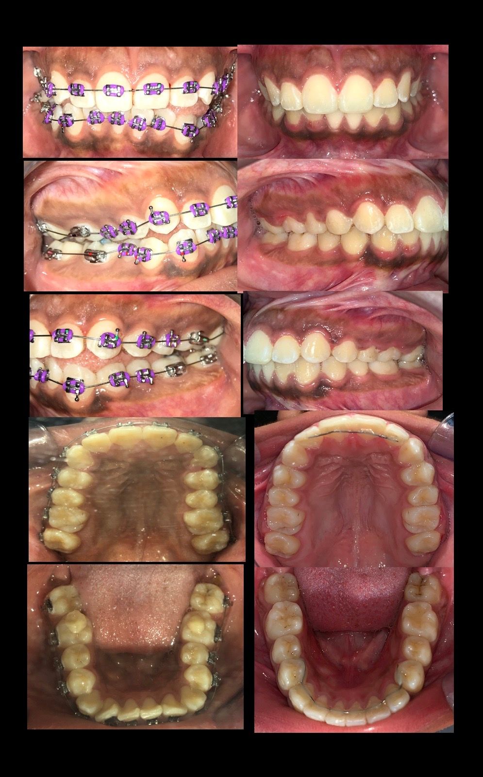 Zuriel Ayala Garcia-15