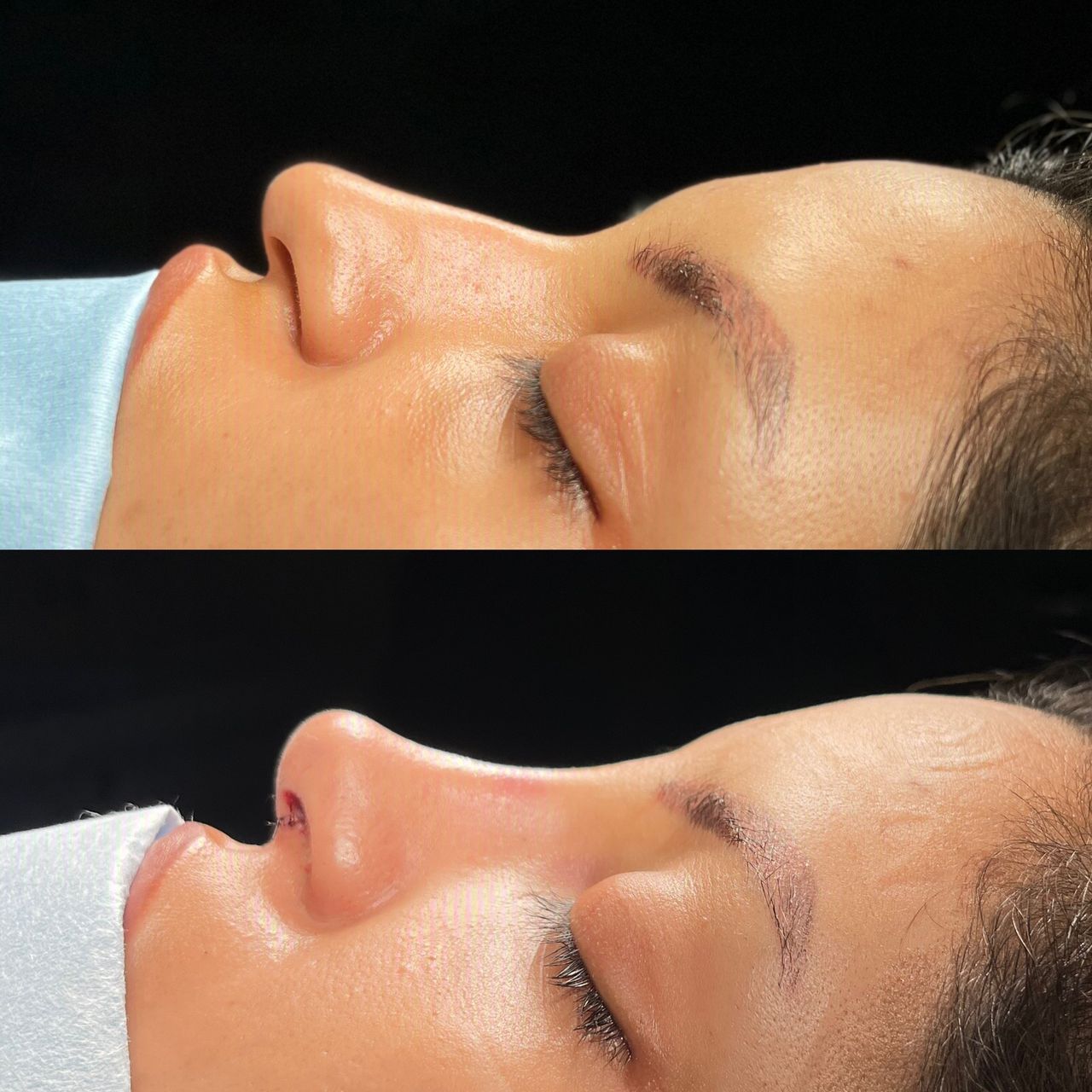 Angel Castro Urquizo-159