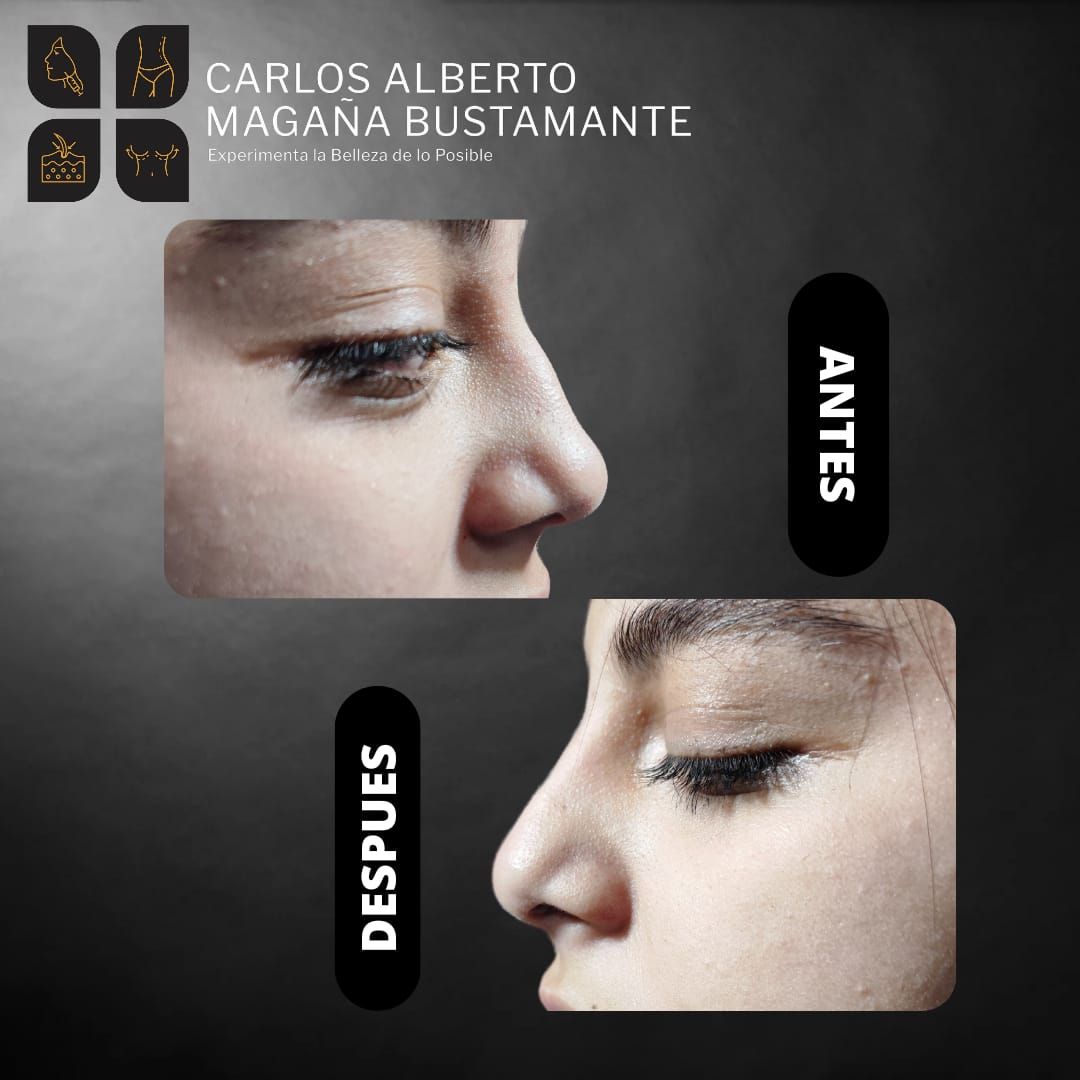 Carlos Alberto Magaña Bustamante-23