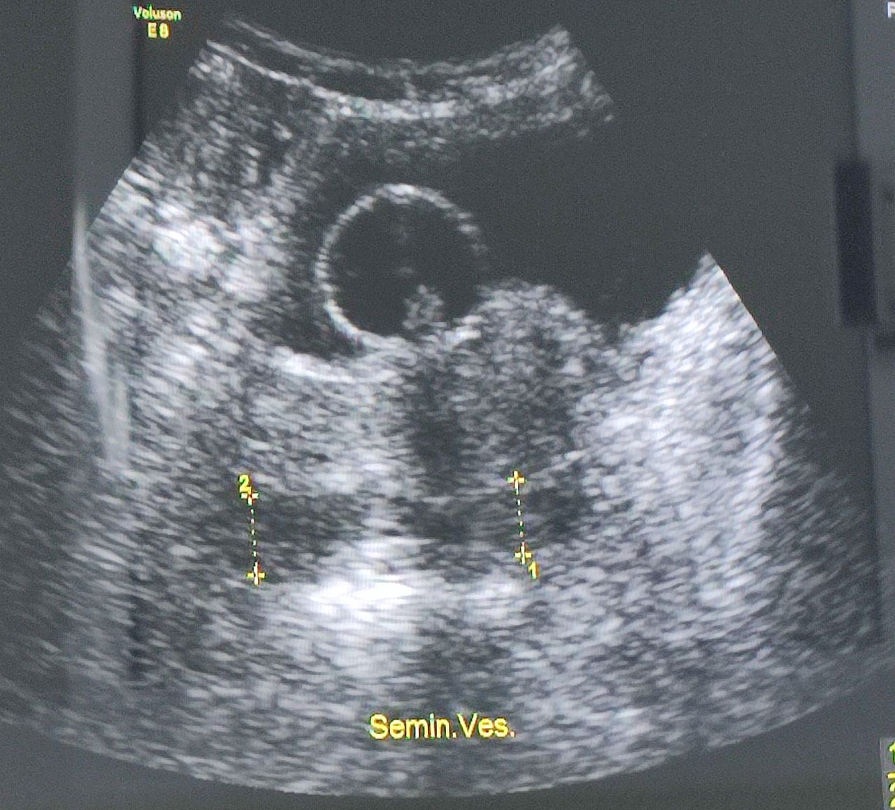 Lázaro Sánchez Vicuña-12