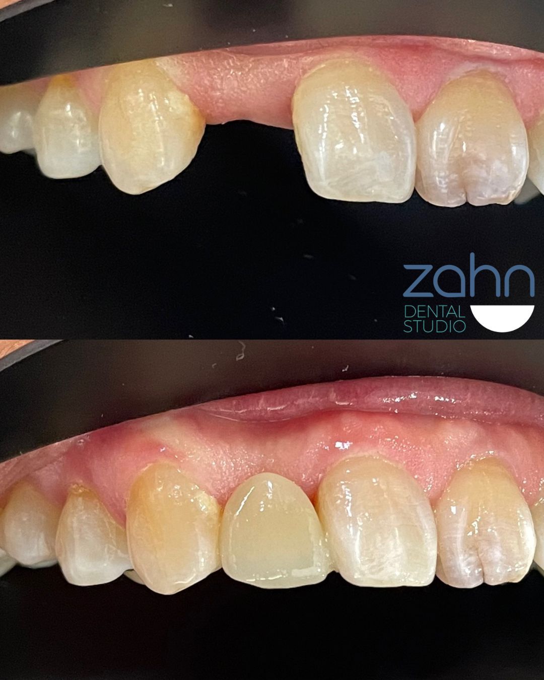 Yury Joven Salcedo-2