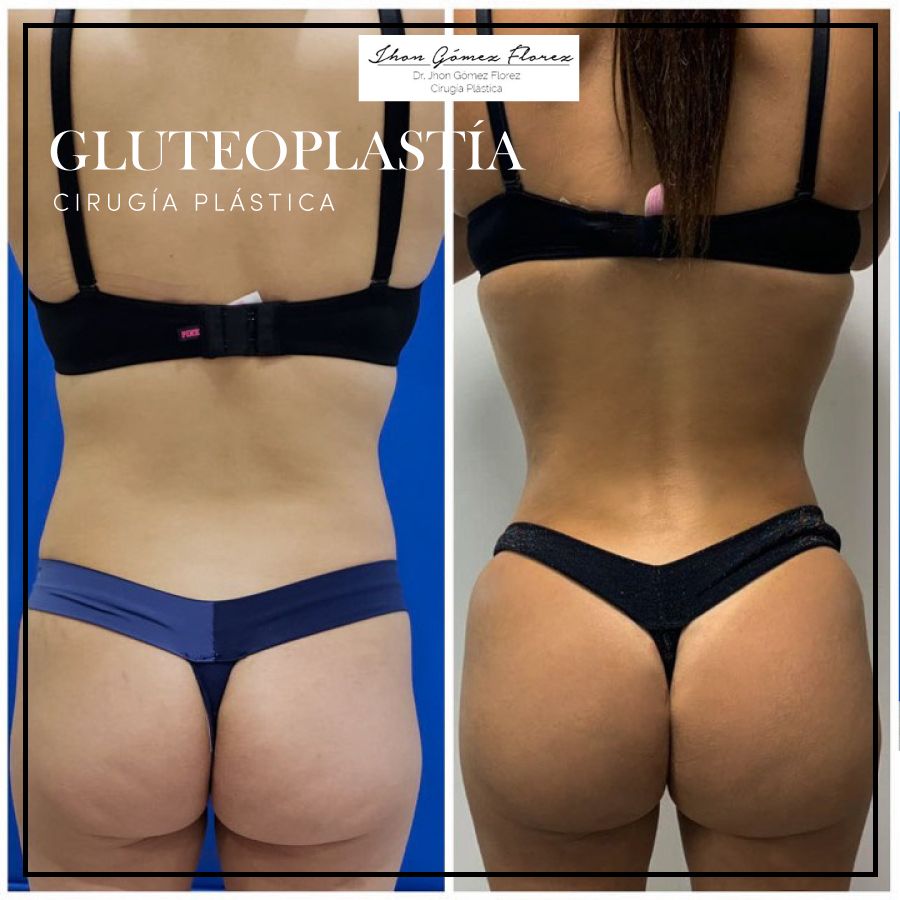 Jhon César Gómez Florez-49