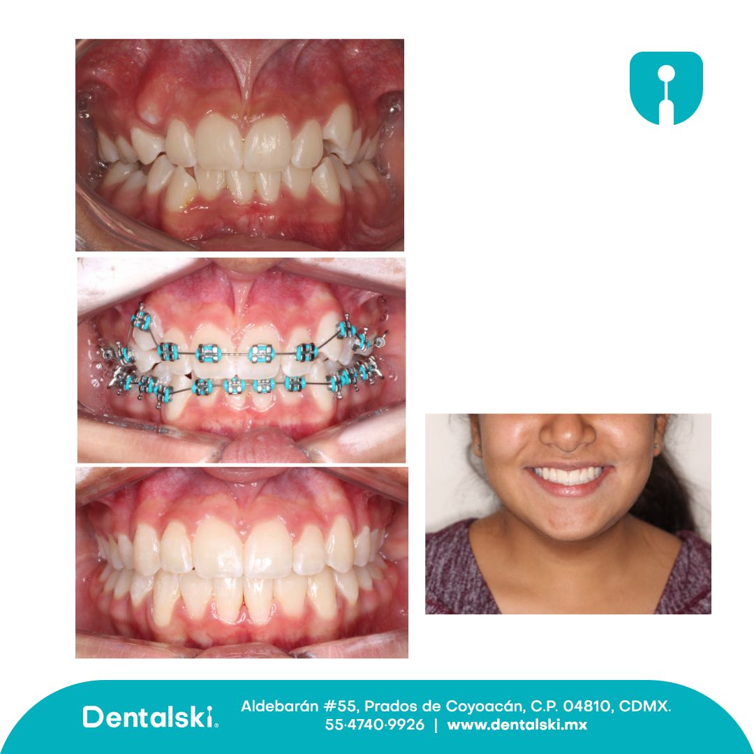 Hugo Gael Méndez Pérez-4