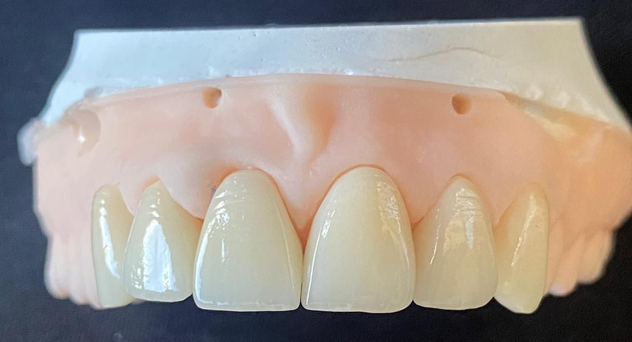 Aimee Valles Monárrez-53