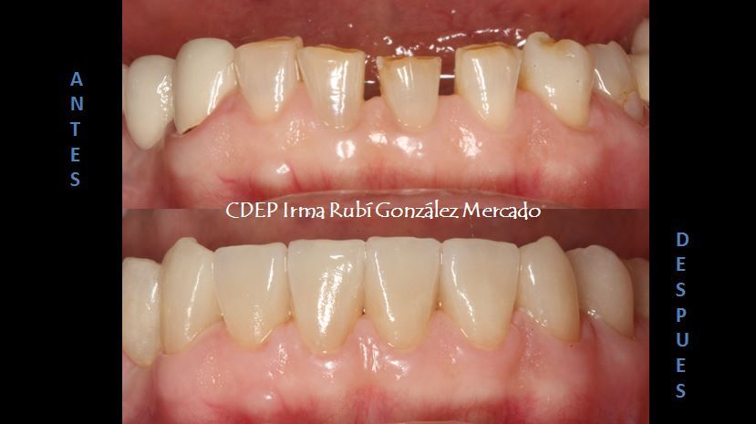 Irma Rubí González Mercado-0