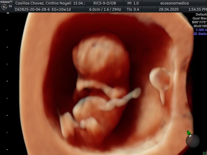 Héctor Bernardo Acevedo Manrique-2