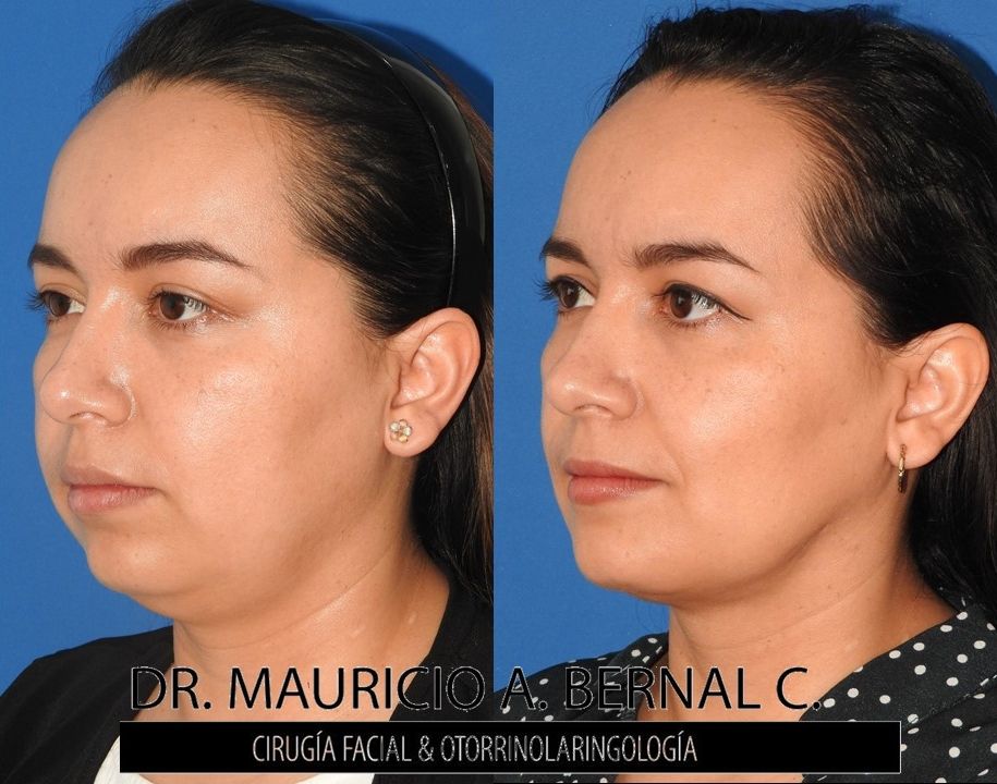 Mauricio Alejandro Bernal Carreon-12