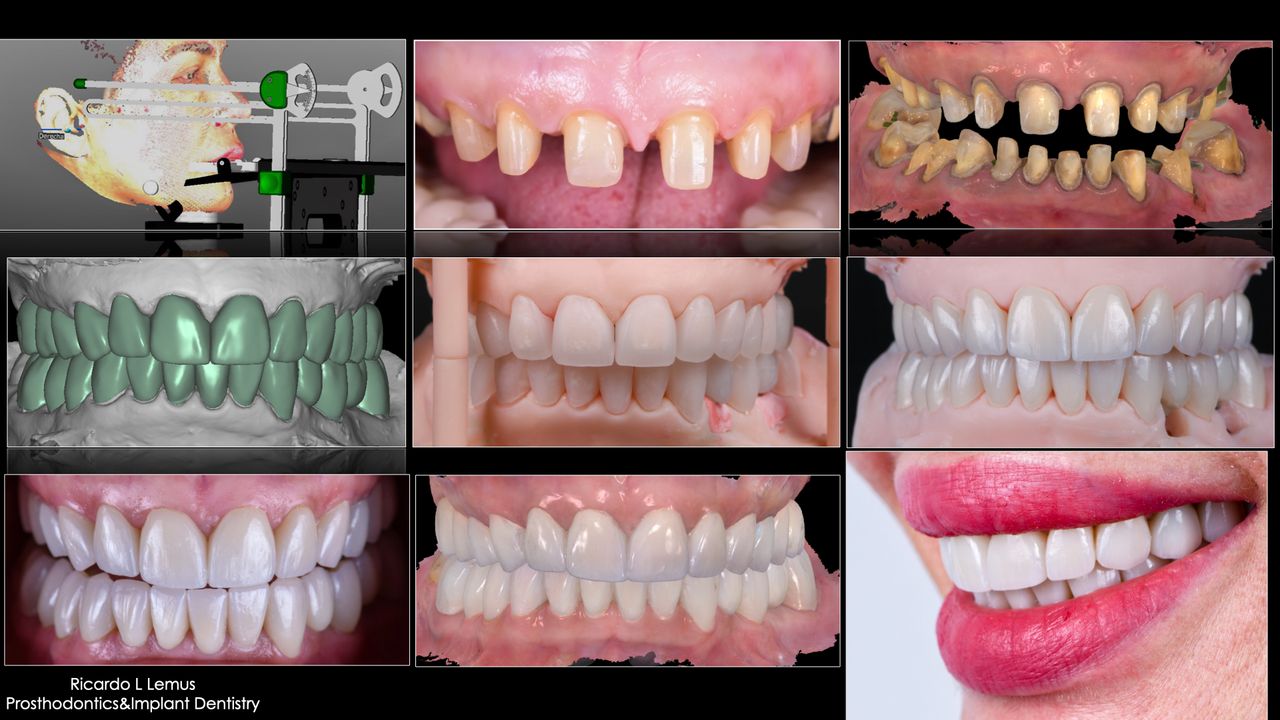 Ricardo López Lemus-12