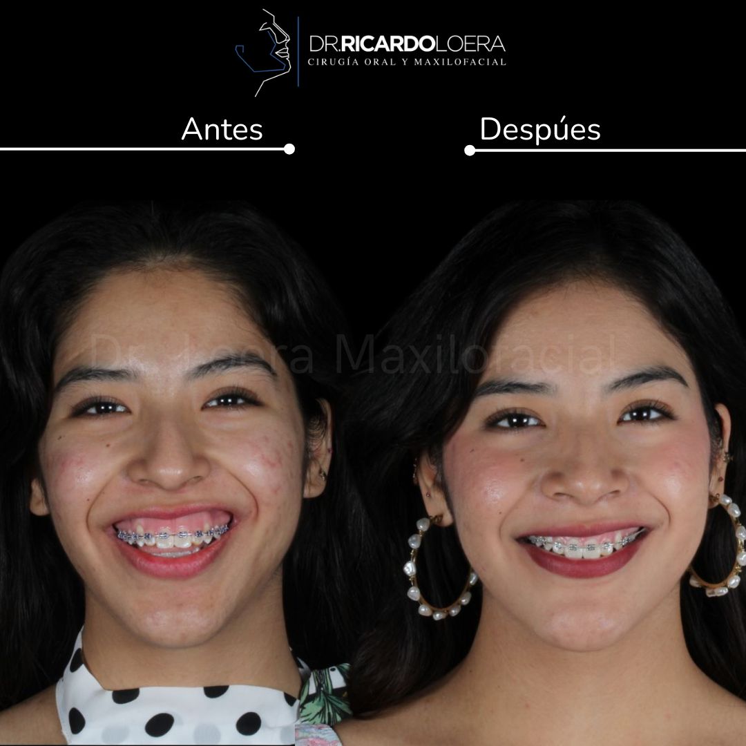 Ricardo Loera Morales-74