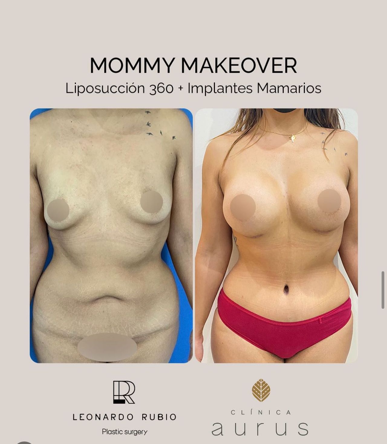 Leonardo Rubio Gomez-6