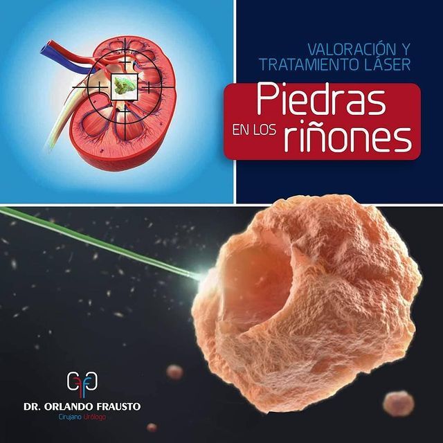 Orlando Frausto Valdes-6