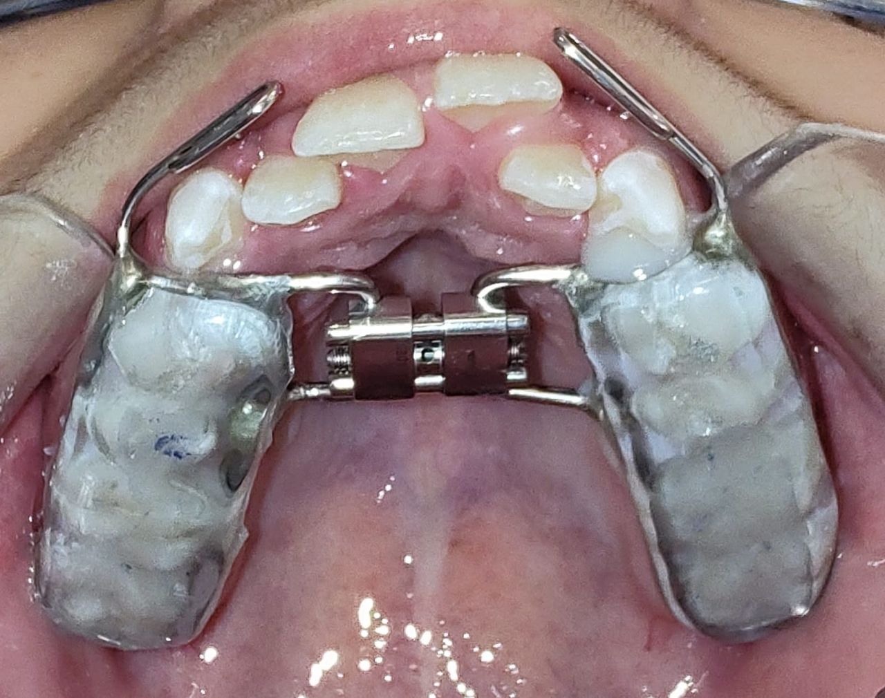 Aimée Quiroz Mendoza-22