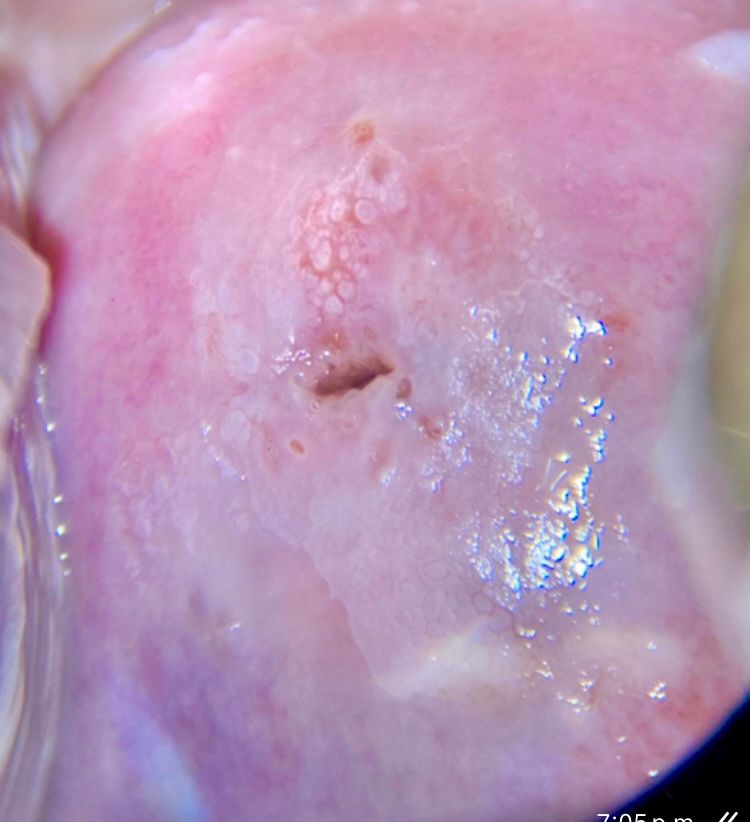 Marcos Javier Cano Luna-1