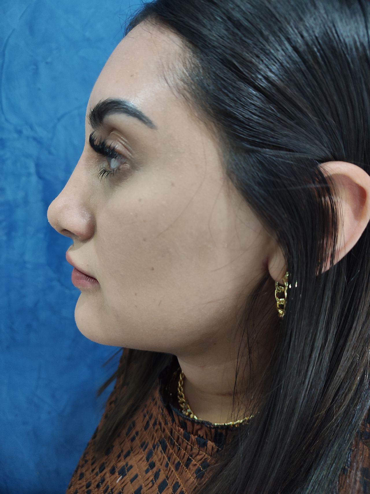 Jacobo Manuel Rotstein Macheleidt-5