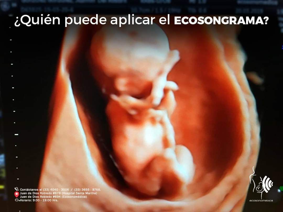 Héctor Bernardo Acevedo Manrique-28