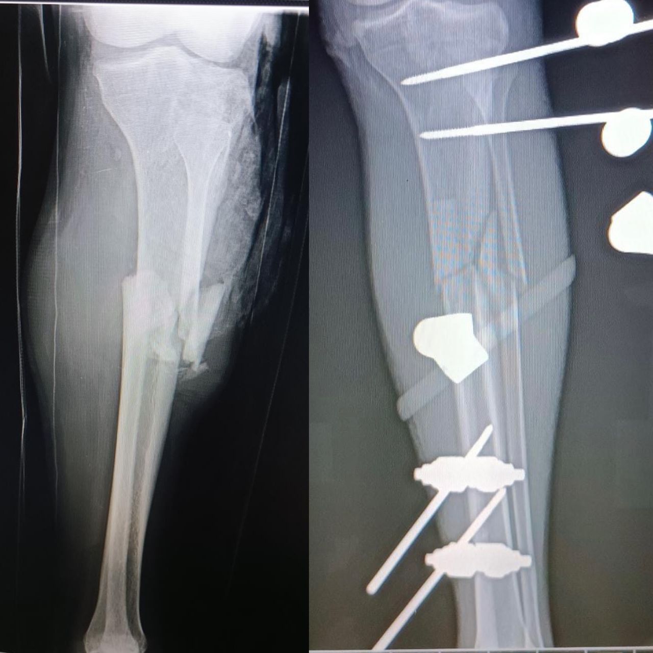 Luis Alberto Monge Bravo-9