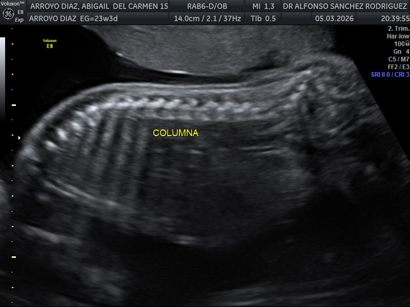 Alfonso Sanchez Rodriguez-70