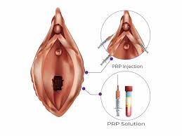 Guadalupe Muñoz Castro-73