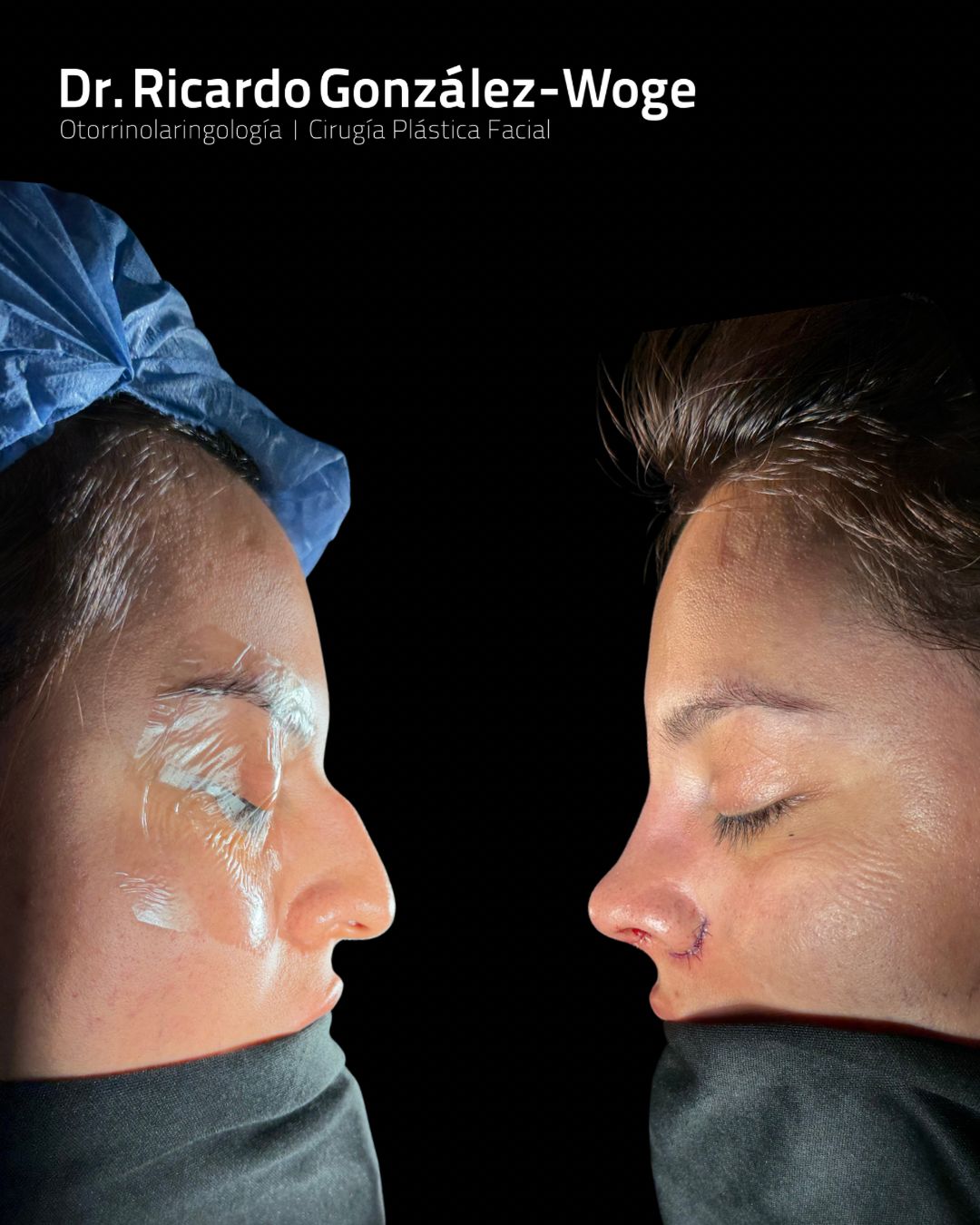 Ricardo Gonzalez Woge-23