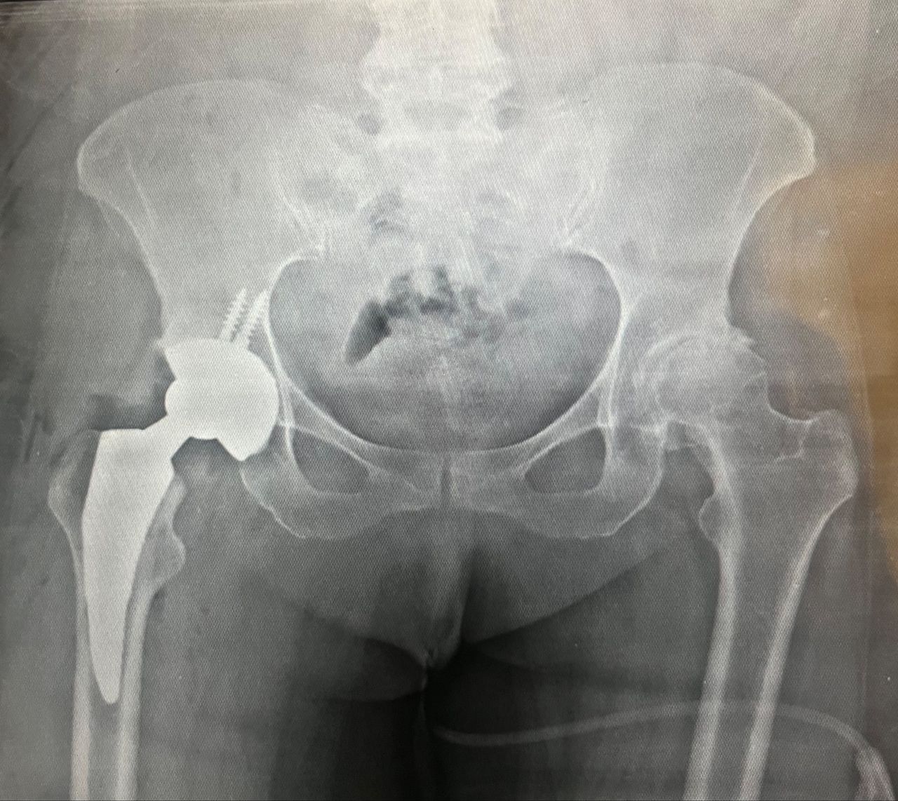 Alejandra Fuentes Martínez-7