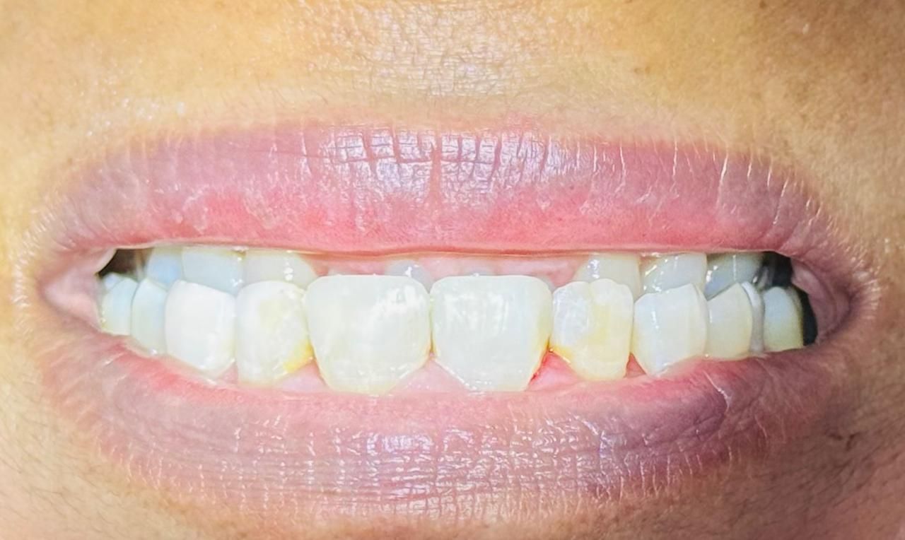 Rocio De La Aurora Carreón Vázquez-3