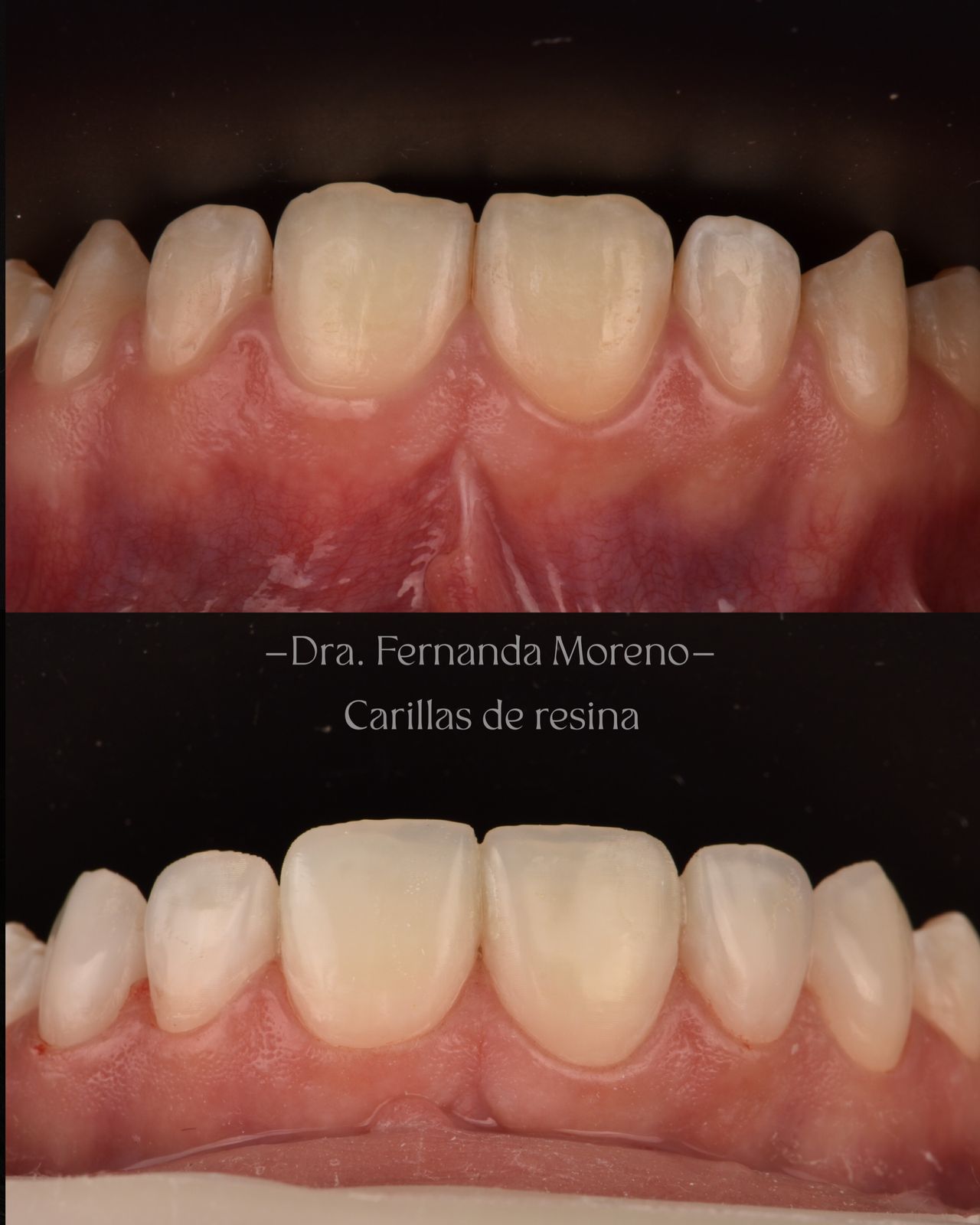 Fernanda Moreno-10