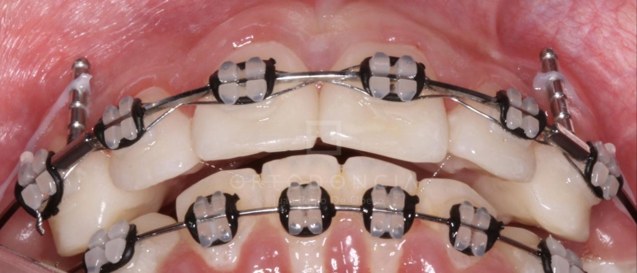 Fabiola Arcos Huesca-33