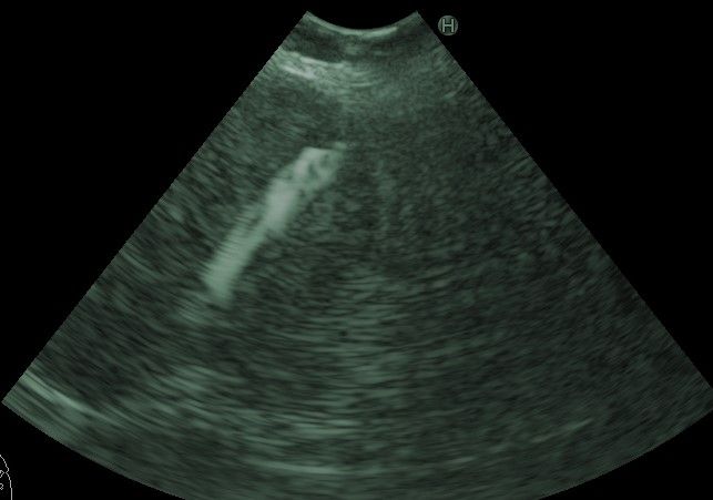 Alejandro Marin Castañeda Baron-5